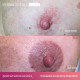 Perma Blend Luxe - The Unstoppable Areola Set (8x 15 ml)